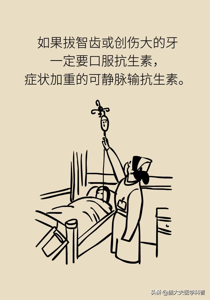 拔牙后疼痛可以用什么消炎药,拔牙后疼用吃什么消炎药