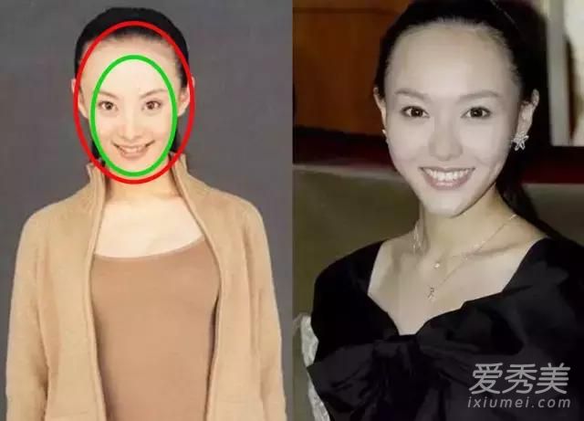 发际线太低显脸大,发际线低怎么办适合什么发型