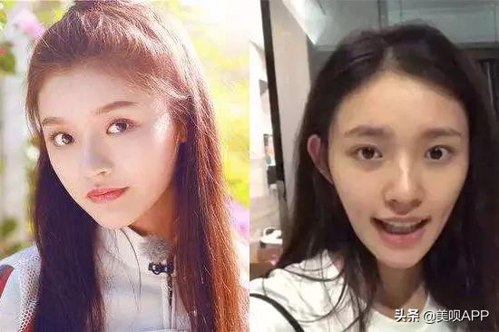 不做医美真的会快速衰老吗,为什么医美使得皮肤衰老更快