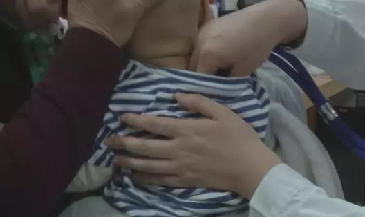 孩子的湿疹反反复复怎么办,儿童湿疹反反复复如何彻底根除