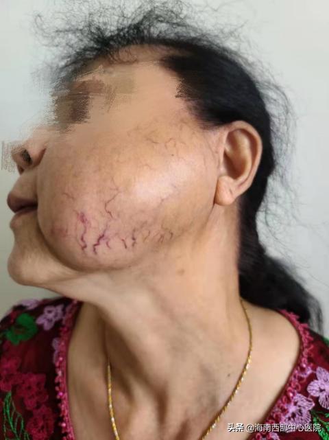 海南西部中心医院进展,海南西部中心医院三期进展