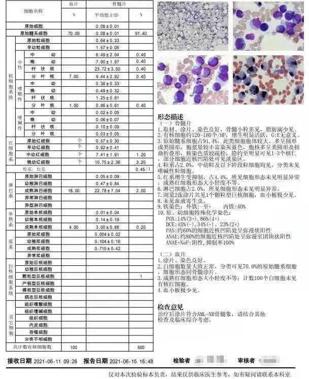 粒单不决问组化?有时还真不一定...