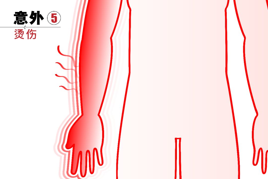 猝死的自救方法几分钟内有效,猝死真就是那样猝不及防吗