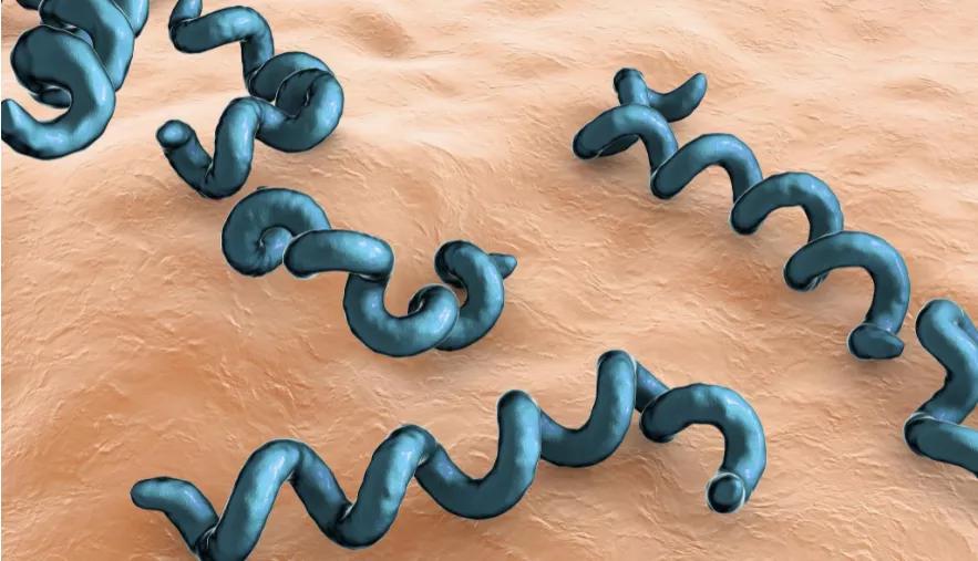 容易被误诊成认知障碍—简谈麻痹性痴呆