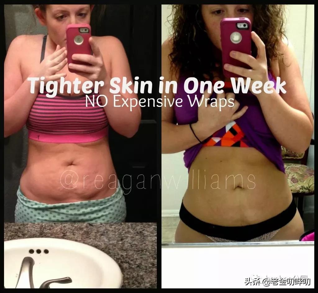 老外马应龙痔疮膏,痔疮膏老外