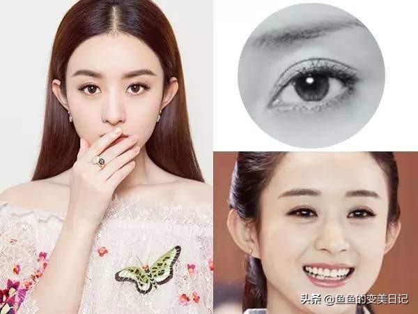 双眼皮知识点总结大全,关于双眼皮的十大真相