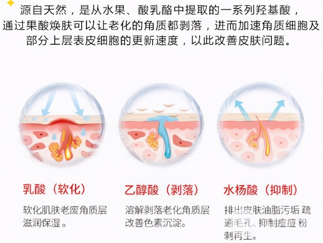 祛痘一般用什么医美,痘肌可以做祛痘医美项目