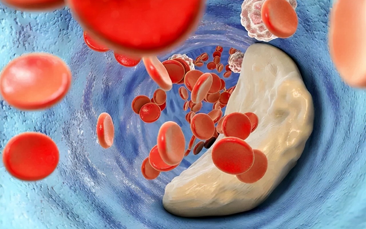 皮下出血紫癜是什么原因造成,皮下出血的意思