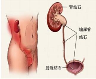 尿液发红是怎么回事正常吗,尿液发红是怎么了