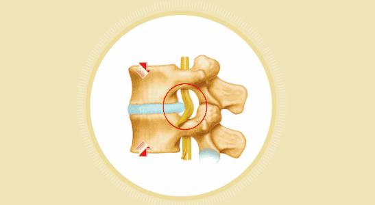 人未老腿先衰的后果,人未老身体已先衰