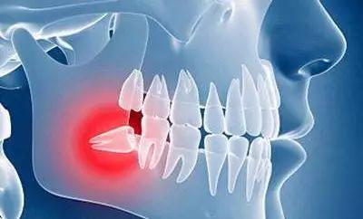 口腔治疗突发情况急救措施,口腔常见急症及处理