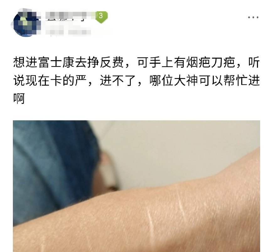 某工友想进富士康工作，却被告知身上有刀疤的不能收