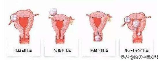 跟婆婆住一个套房总是被气怎么办,和婆婆住一起每天被气的要死