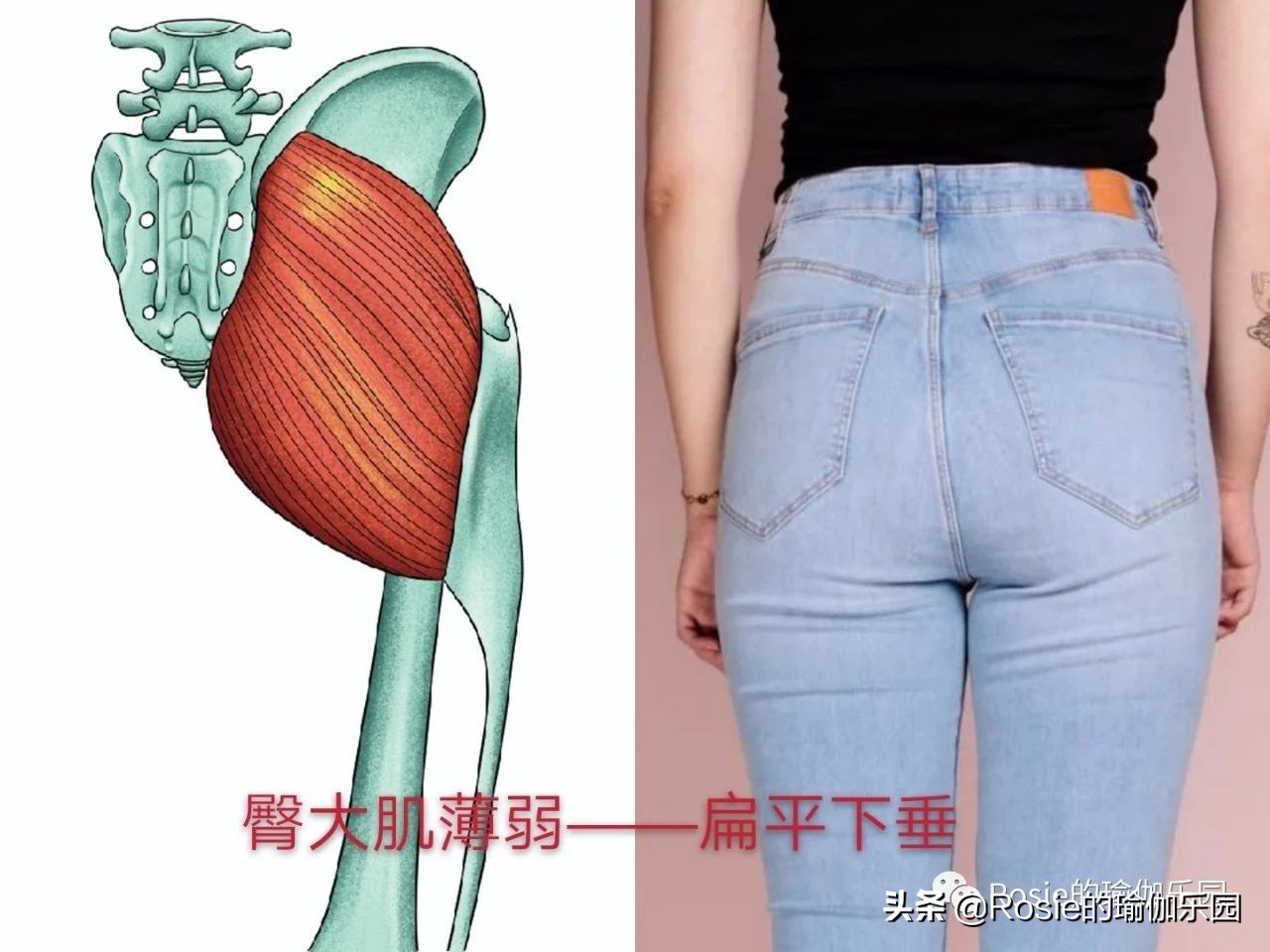 一个动作判断你是不是翘臀,你以为的翘臀很可能是骨盆前倾