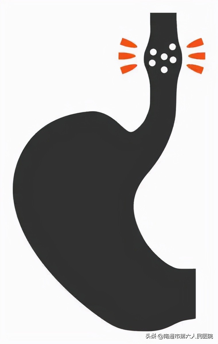 食管癌无法进食不能装支架怎么办,食管癌无法耐受放疗