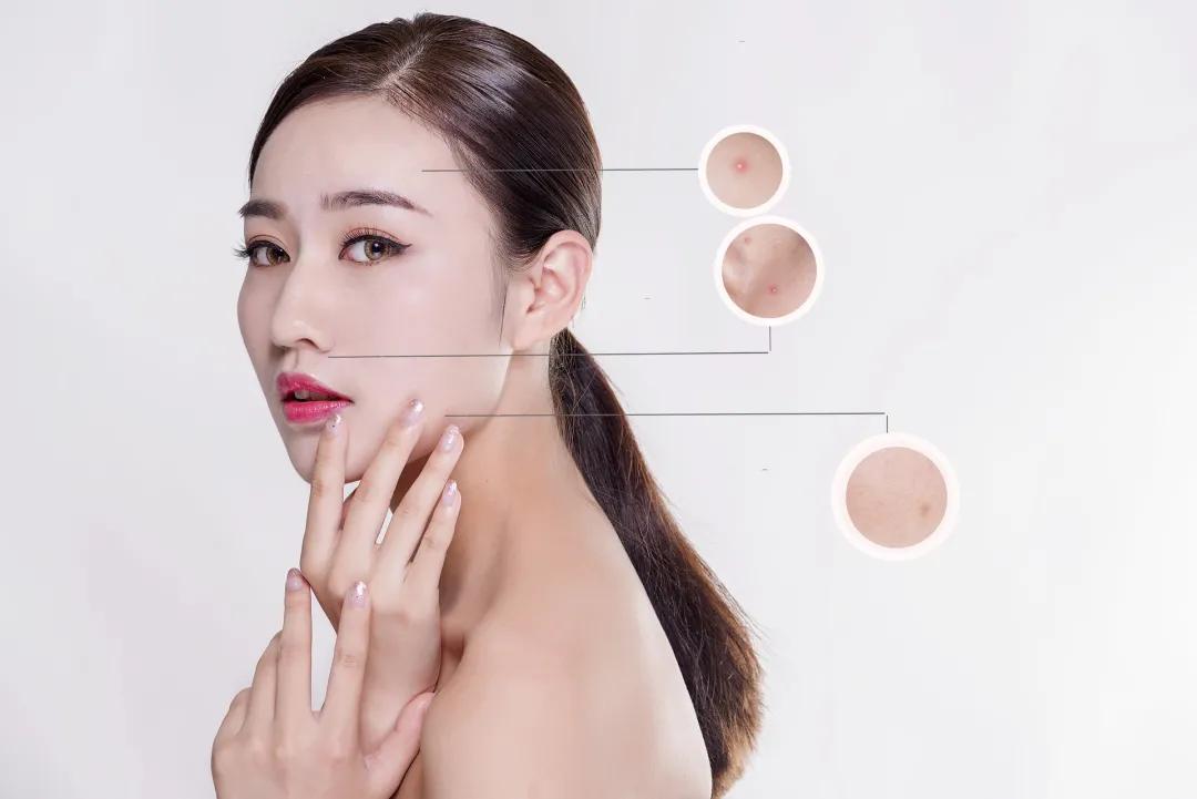 毛孔堵塞如何护肤才能更好吸收,手臂毛孔堵塞怎么疏通毛孔最有效