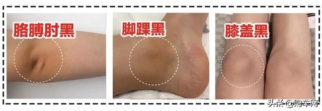 洗澡时搓出泥状物好不好,搓泥搓出来白色的是什么