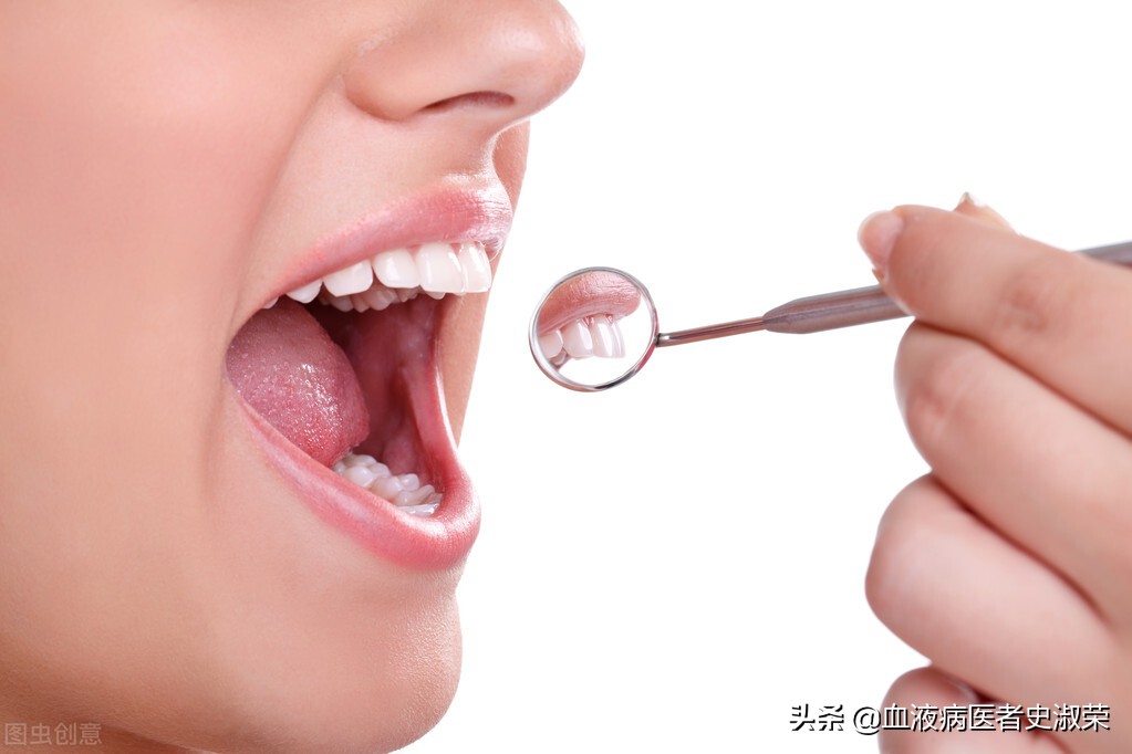 再障牙龈老流血咋办,最近刷牙牙龈总是出血是怎么回事