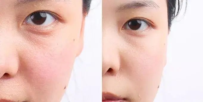 春雨蜂蜜面膜真实测评,春雨蜂蜜面膜用法及功效