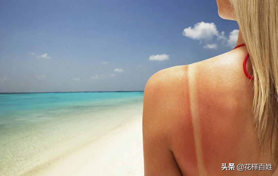 皮肤被晒脱皮了如何修复,皮肤脱皮泛红用什么修复