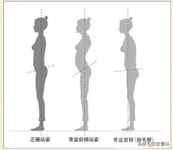 骨盆那些事儿：骨盆错位是女性疾病根源