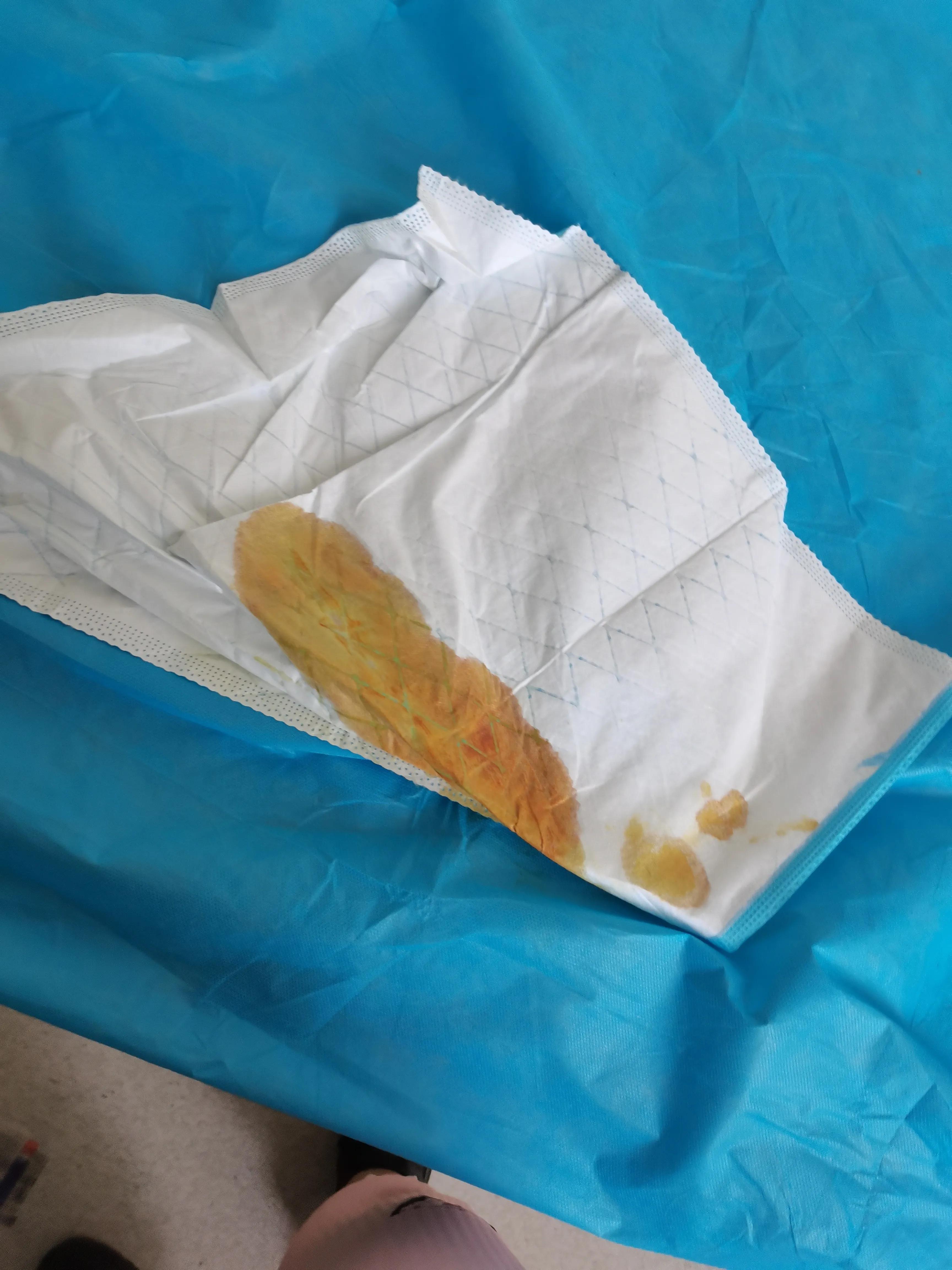 40周+5天，我是进来了，却一点也不好受