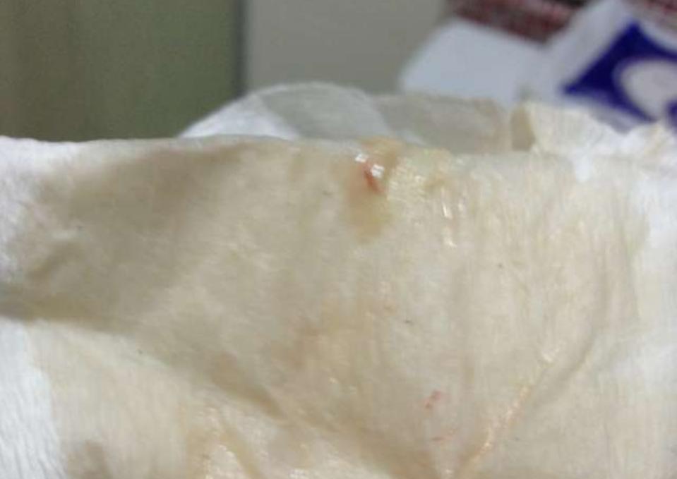 单绒双羊37周需要提前住院待产吗,孕妇最多可以提前多少天住院待产