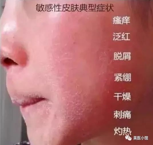 可复美敏感修复用哪款面膜,可复美敏感肌肤产品