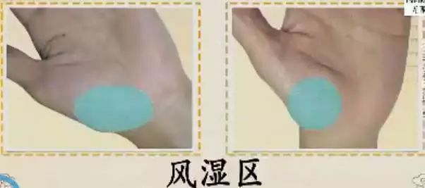 手上出现这些变化可能是疾病信号,手的颜色能看出健康的问题吗