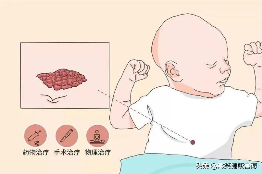 全身皮下能摸到小疙瘩,身上皮下摸到小疙瘩