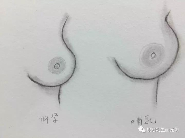 乳房发育早熟症状,乳房发育早熟怎么消下去