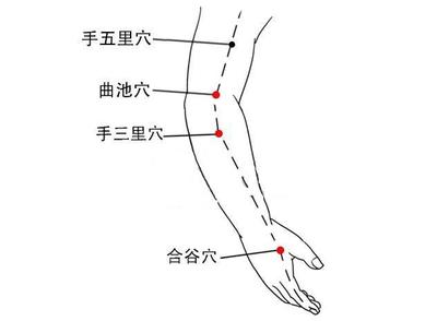 肩颈椎病手关节痛针灸哪些穴位好,颈椎病头晕呕吐针灸哪些穴位