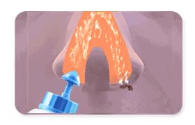 慢性鼻炎长期鼻腔冲洗,鼻炎洗鼻腔能有多脏