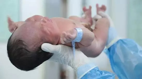 怀孕如何避免侧切,为什么孕妈怕撕裂