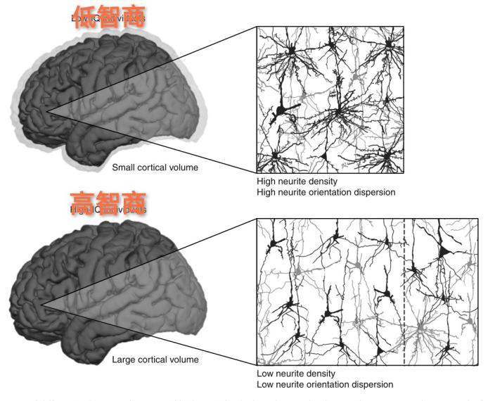 左撇子和右撇子大脑的区别,左撇子和右撇子大脑结构差别