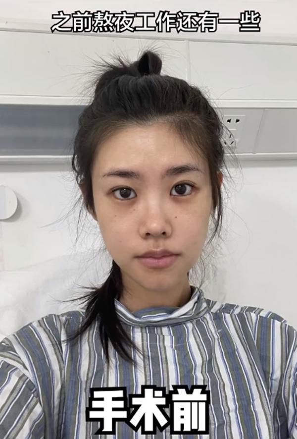 25岁千万粉网红患上卵巢癌！手术切除一侧附件，肿瘤破碎子宫出血