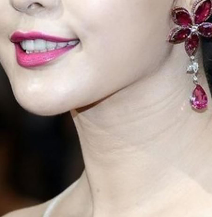 出现颈纹怎么办如何有效消除颈纹,颈纹怎么消除简单方法淡化颈纹