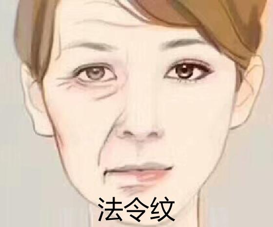 笑能笑出法令纹吗,笑得太多了就有法令纹吗