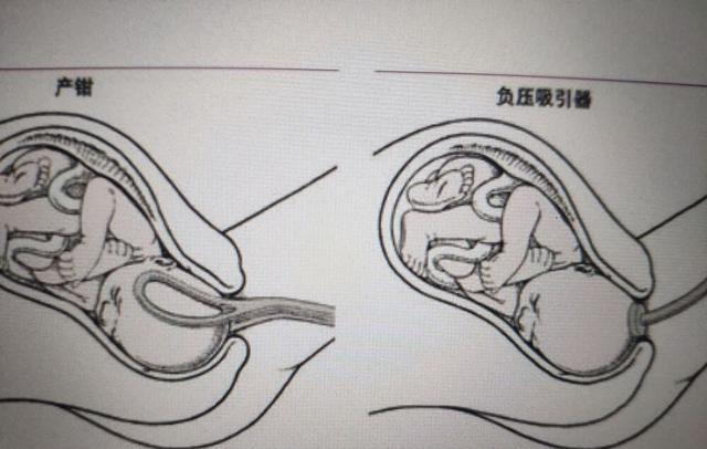 岳云鹏老婆再剃光头,岳云鹏老婆为什么剃光头