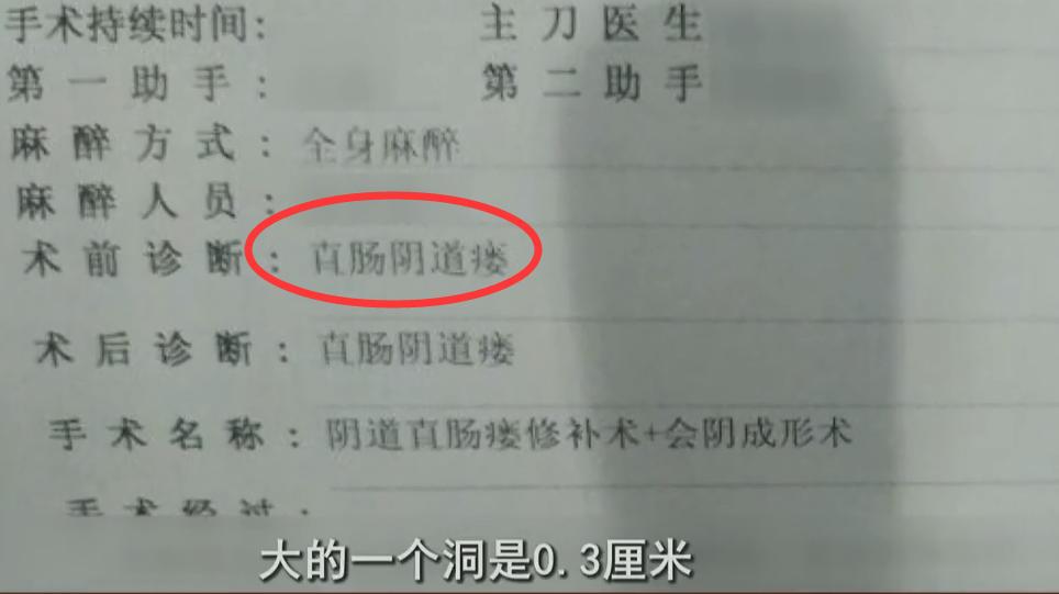 漏尿手术后出血了,妇女手术后漏尿最有效的恢复方法