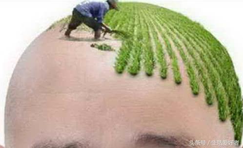 脱发植发行业行情,植发行业井喷式