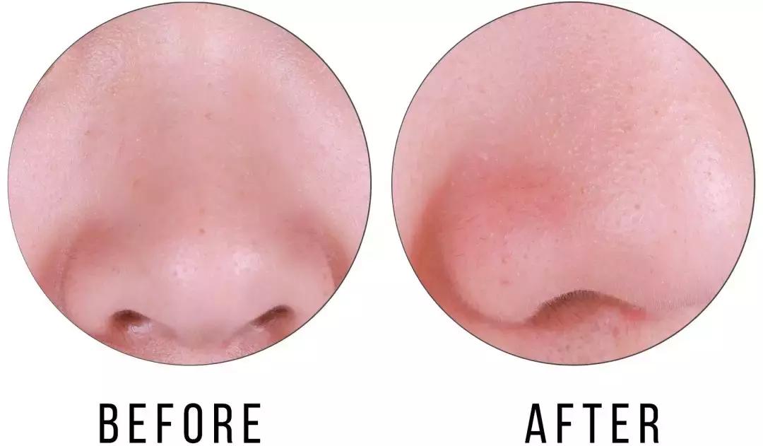 honeyroa面膜,好用的去黑头清洁面膜排行榜