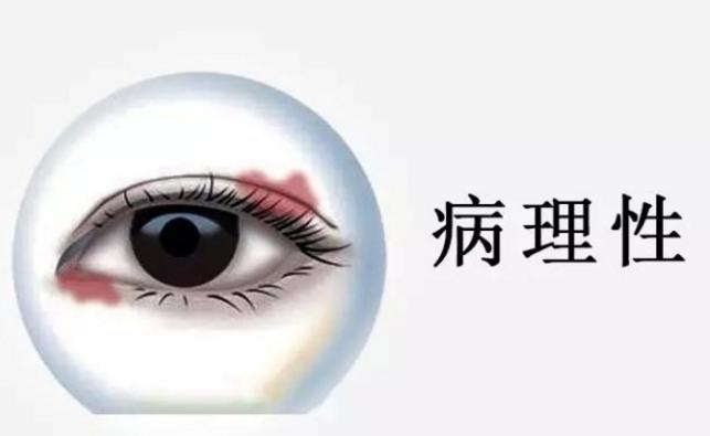 为什么左眼皮跳财右眼跳灾,左右眼皮跳有科学依据吗