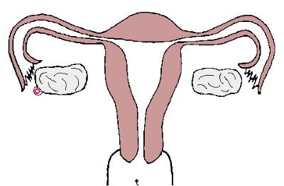 回「宫」之路不通，输卵管的路况信息该怎么查？