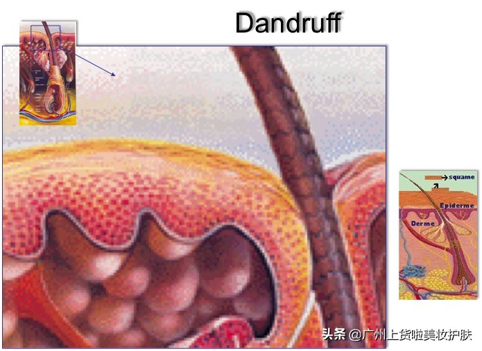 头皮经常发痒怎么办,头皮总是痒是什么原因怎么缓解