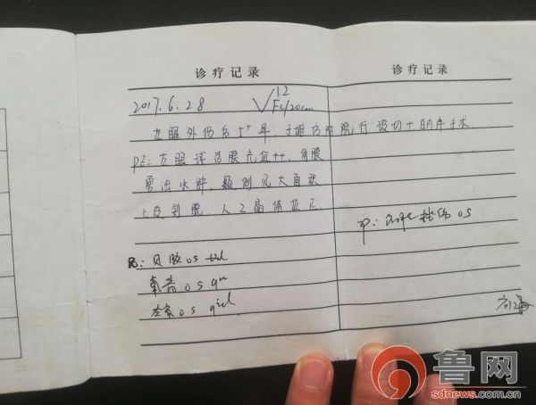 眼睛手术一年还可以拆线吗,眼部手术后14天拆线正常吗