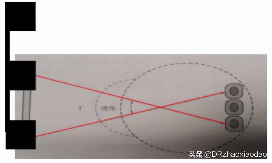 视力1.0+正常吗,视力1.0+能降低眼睛度数吗
