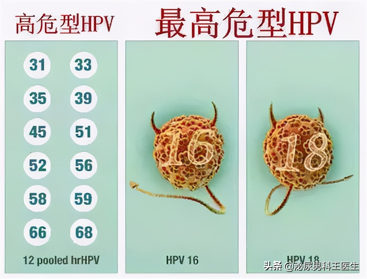 难以启齿的病很常见,难以启齿的病是什么病