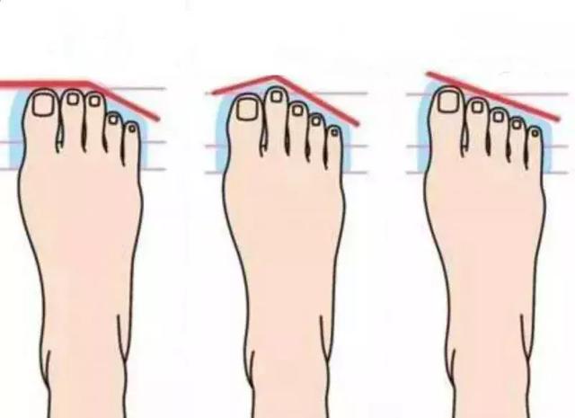 除了匡威，你还有很多选择