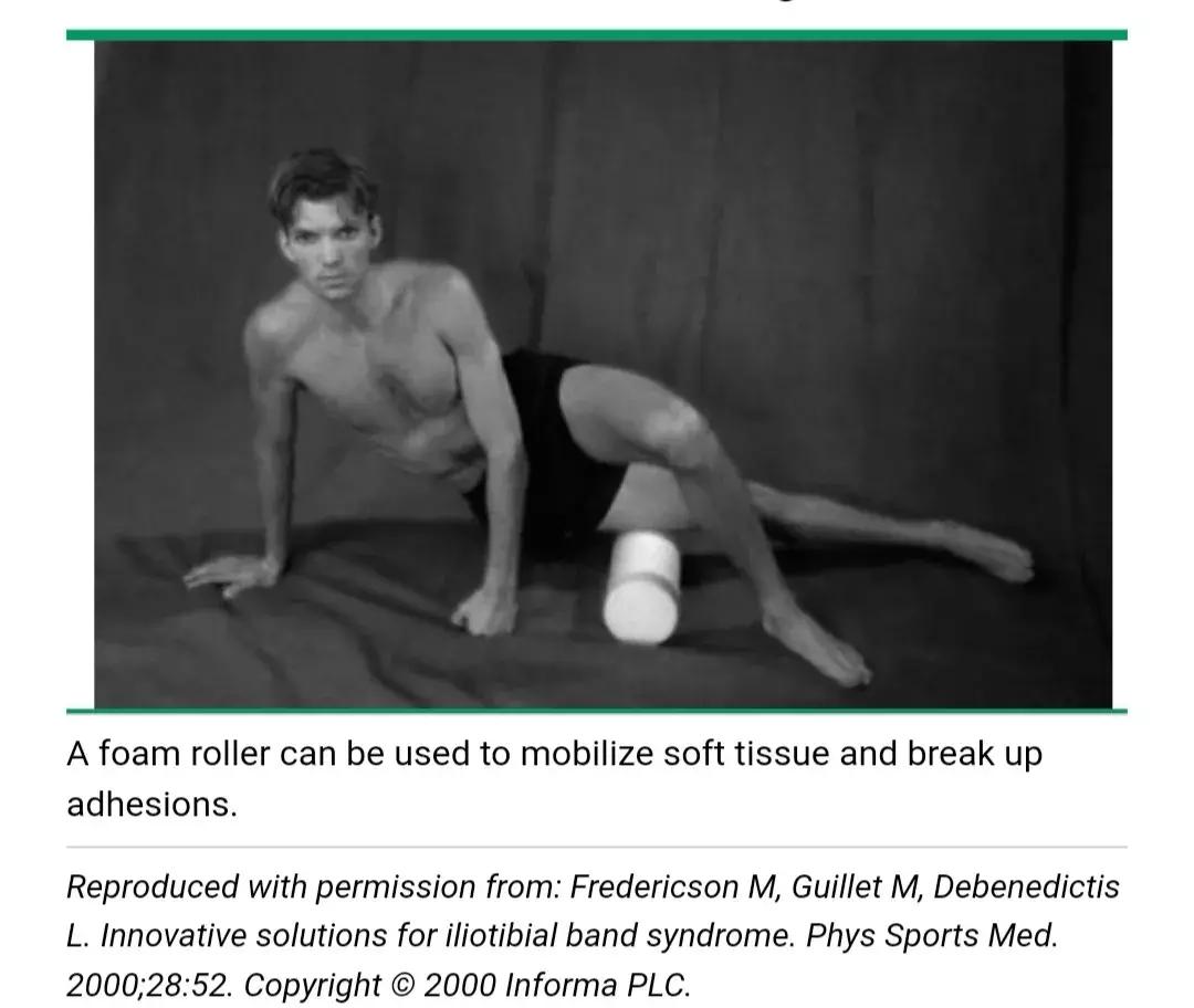 跑步膝盖髂胫束疼痛怎么治疗,跑者最怕的疾病